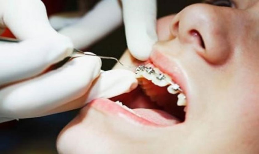 Cách để phân biệt được nha khoa uy tín và nha khoa kém chất lượng
